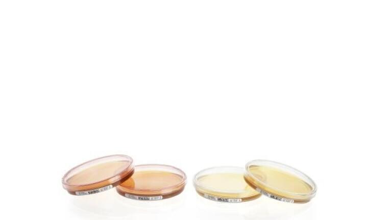 Passive Air Monitoring of Microbial Contaminants: Don’t Settle for Second-Best