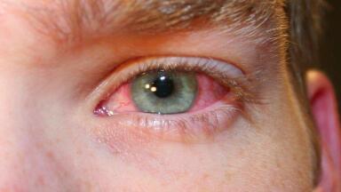 New Occupational Exposure Limits Set for Peracetic Acid