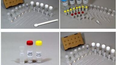 Enzyme-Based Nitrate Test Kits Introduced