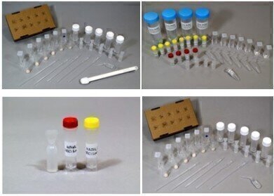 Enzyme-Based Nitrate Test Kits Introduced
