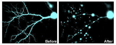 Stimulating Neurons Could Protect Against Brain Damage