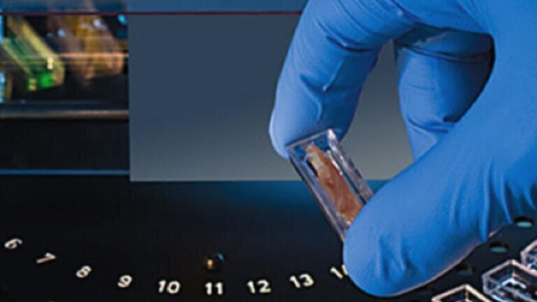 Which is the best method of mercury analysis for your lab?