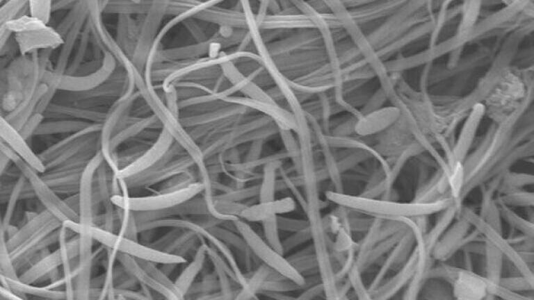 A high magnification picture using a scanning electron microscope (SEM) photo of some Echinogammarus marinus sperm