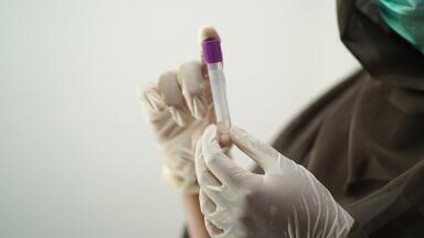 Grab Samples vs Composite Samples - What's the Difference?
