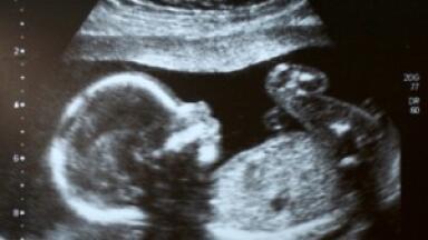 Not enough is known about the amount and effects of microplastics on foetuses and children