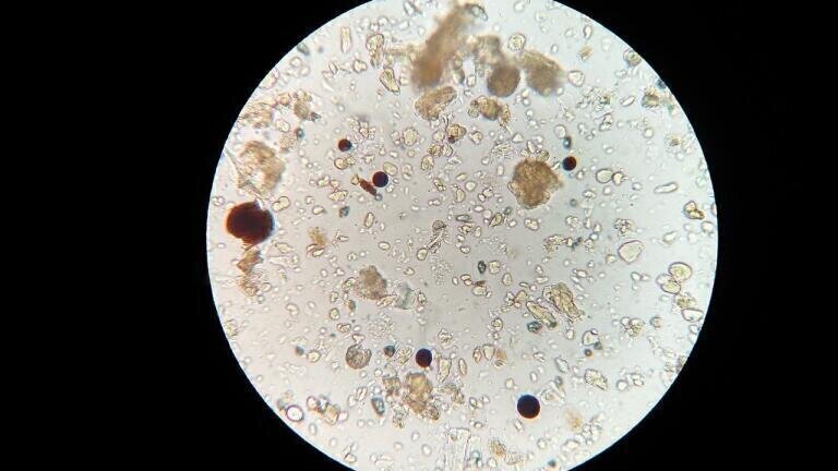 How Is Mercury Detected?