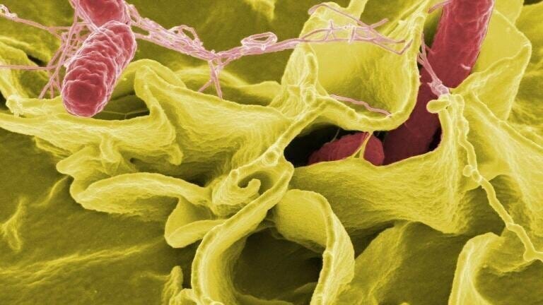 12 Diseases Caused by Water Pollution