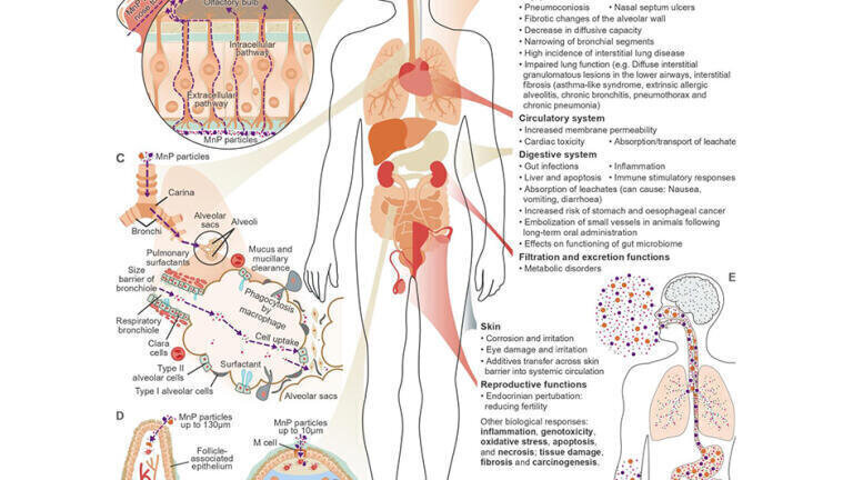 Figure 2. Hypothesized uptake mechanisms of MnPs through human body (A–D) (A) Hypothesized uptake mechanisms of MnPs through human biological barriers, including via (B) the olfactory bulb, (C) the lung-air barrier, and (D) the gastrointestinal tract, indicating also the systems and organs directly affected by MnPs and the associated MnP impacts and suspected adverse health out comes including NCDs. The suspected particle-size fractionation caused by differences in the uptake mechanisms (A–D) is highlighted in (E), with larger particles being ingested (up to 130 mm) rather than inhaled (%2.5 mm) and only the smallest (nanoscale) particles being able to penetrate the blood-brain barrier. MnP internalized by routes (C) and (D) reach the wider circulatory system and from there can reach all organs.