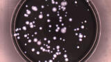 Detection of Legionella in Contaminated Water Supplies