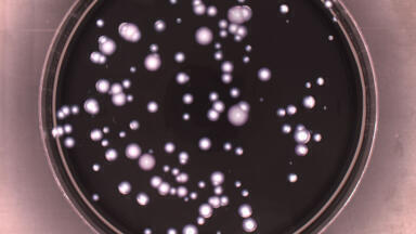 Detection of Legionella in Contaminated Water Supplies