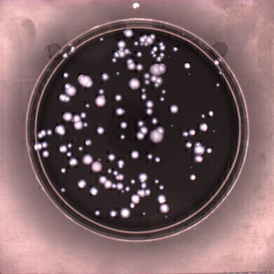 Detection of Legionella in Contaminated Water Supplies