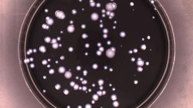 Detection of Legionella in Contaminated Water Supplies